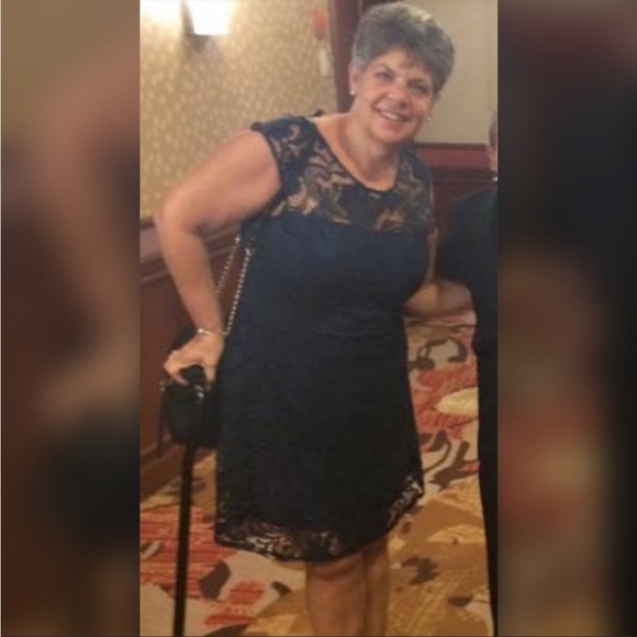 ✨Lace Cocktail Dress - Picture 3 of 5